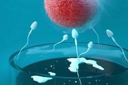 助孕技术中眼怎么进行选择呢？是试管婴儿技术好还是扔授精技术好