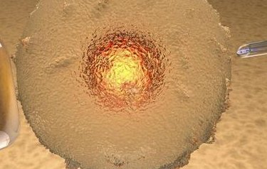 南充做试管婴儿的医院有哪些？南充试管婴儿治疗流程是怎样的？